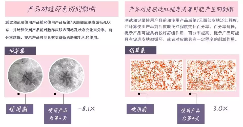 植美村化妆品是哪国的,国产护肤品排行榜了解一下,植美村化妆品